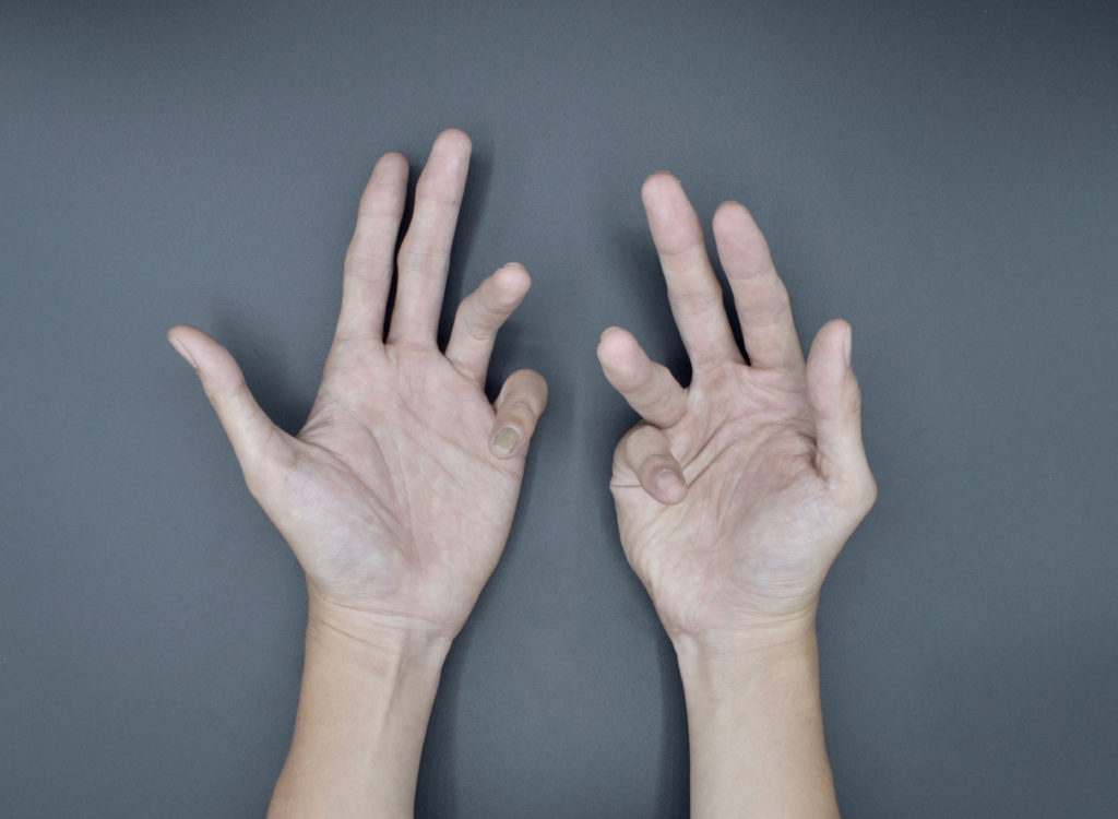 marijuana for spasticity