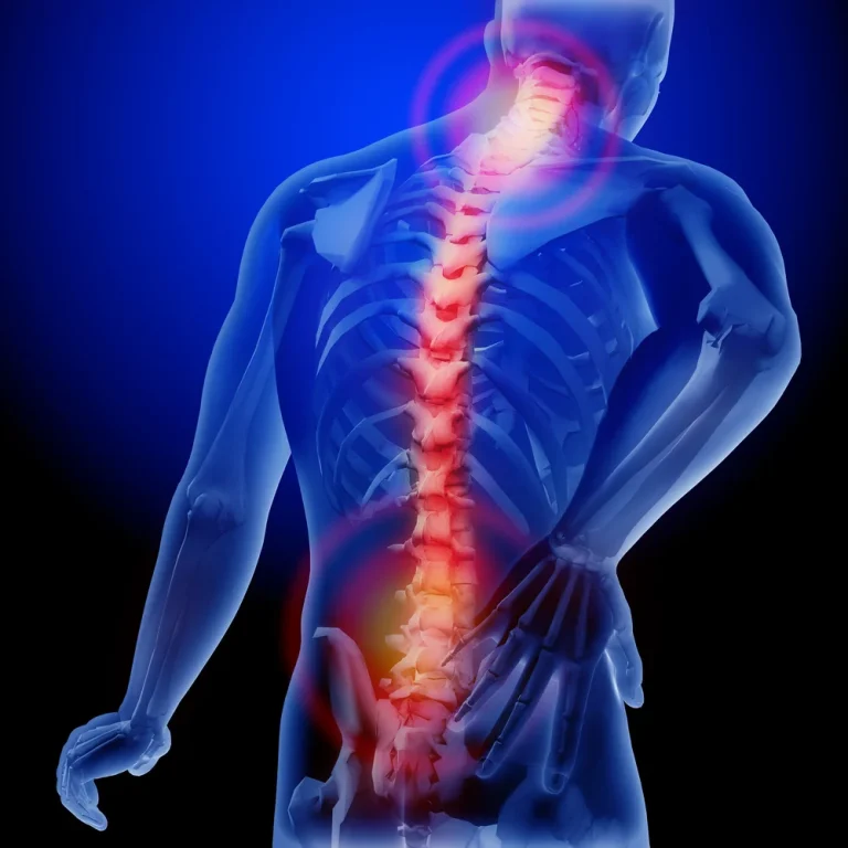 Medical Marijuana for Bank Pain